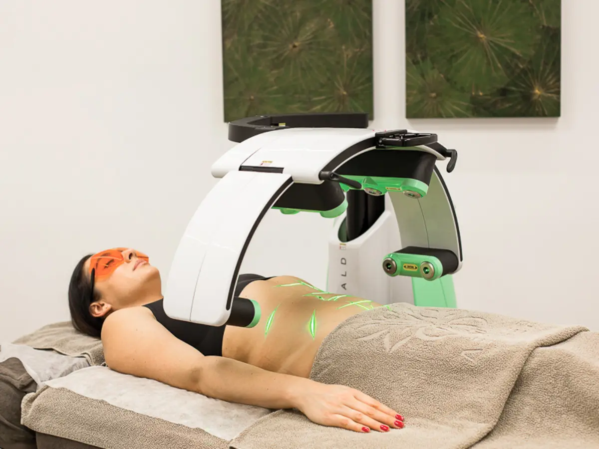 Laser pour maigrir : que faut-il savoir ?